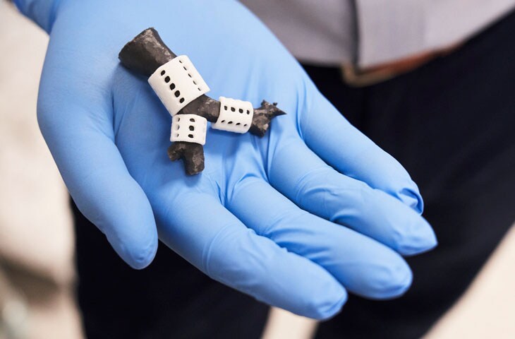 3D printed tracheal splint